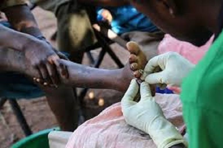 Poor families seeking help to upgrade houses and uproot jiggers